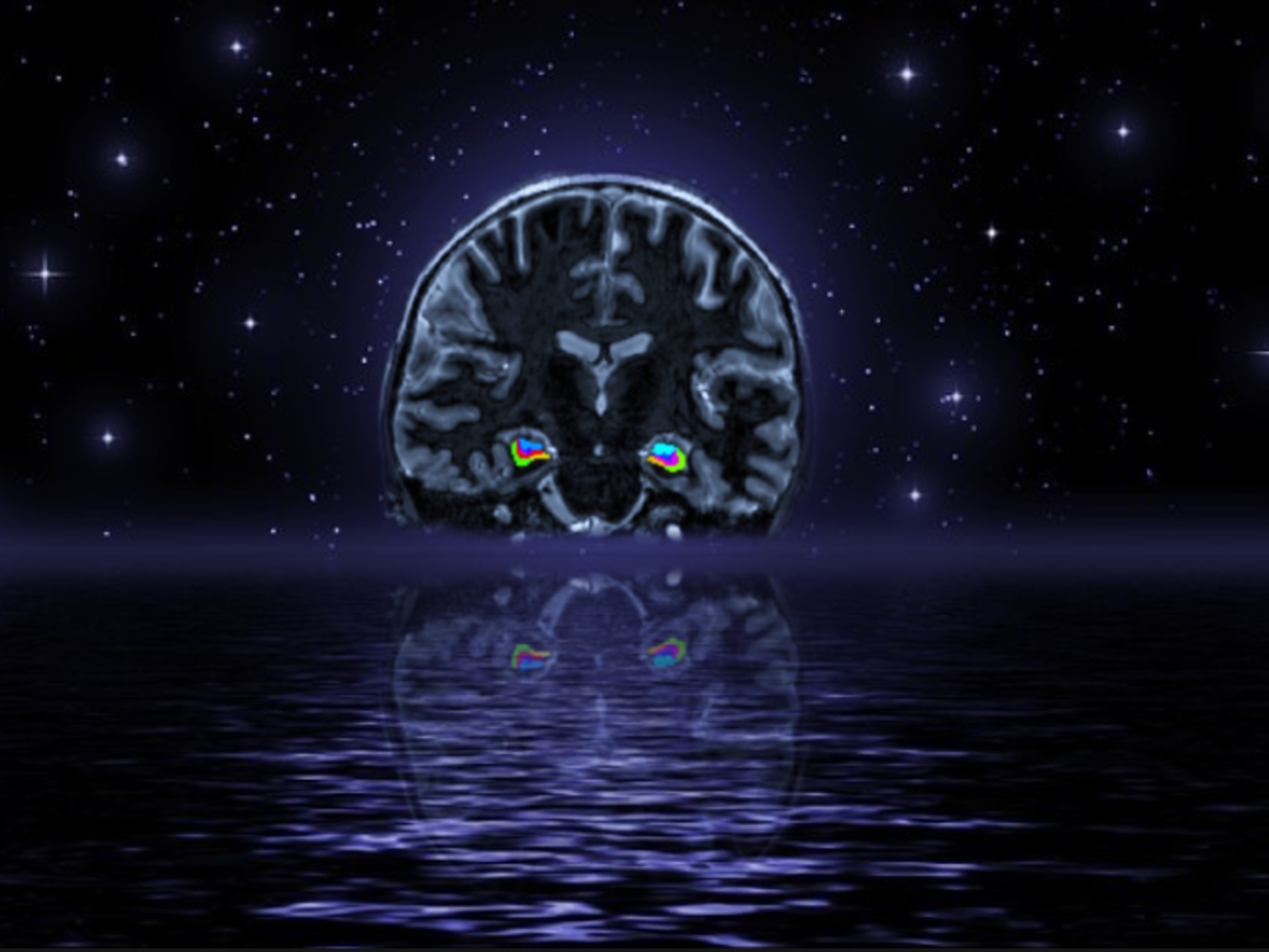 Hippocampal Moon